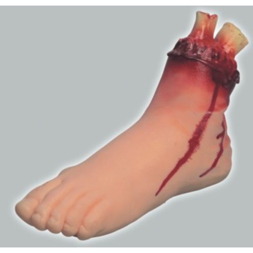 Blutender Fuß